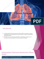 Fibrosis pulmonar: guía diagnóstica y tratamiento