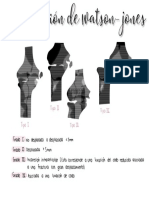 Clasificación de Watson-Jones 2