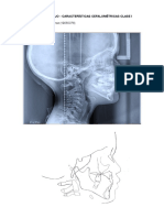 Primer Trabajo - Características Cefalométricas Clase I