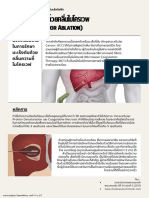 Microwave Tumor Ablation