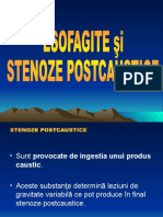 Stenoze Esofagiene Postcaustice