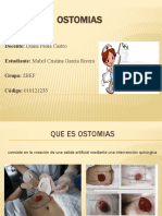 Cuidados y tipos de ostomías