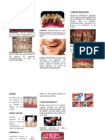 ENFERMEDAD PERIODONTAL Triptico