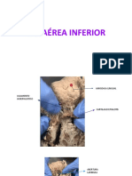 Via Aerea Inferior