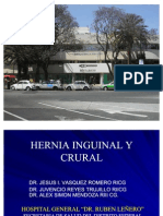 Hernia Inguinal y Crural