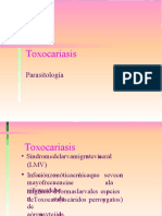 Toxocariasis