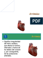 Arritmias Factores Riesgo 125013