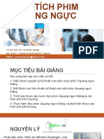 Đọc Phim x Quang Ngực