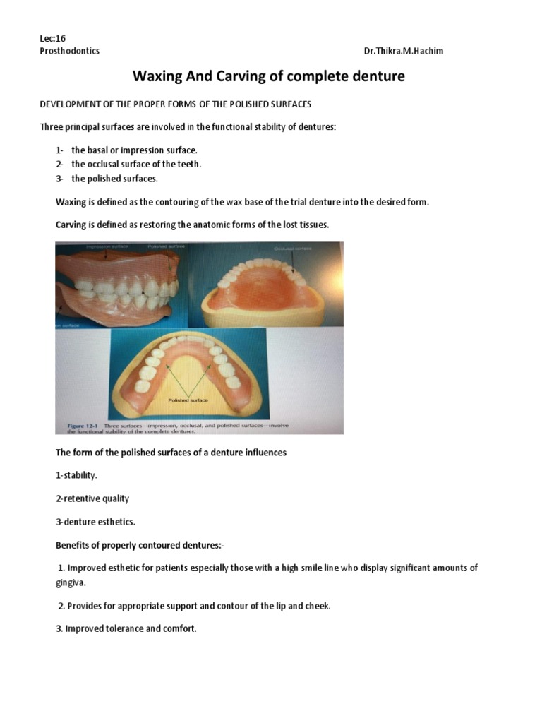 Waxing and Carving of Complete Denture PDF Dentures Dentistry