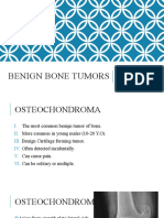 Benign Bone Tumors