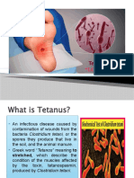 Understanding Lockjaw: An Overview of Tetanus