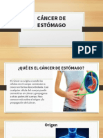 Cáncer de Estómago