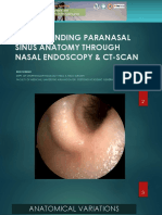 Understanding Paranasal Sinus Anatomy