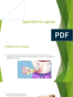 Apendicitis Aguda