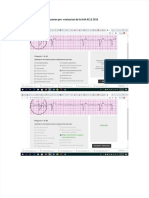 PDF Pre Evaluacion Svca Acls Aha 2015 Con Los Trazados Del Ekg y Respuestas