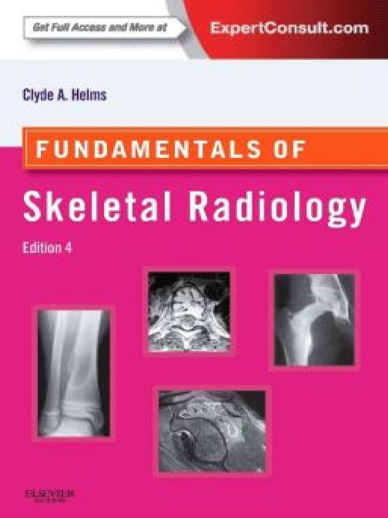 Fundamentals of Skeletal Radiology Compress PDF Ct Scan Radiography