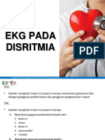 Ekg Disritmia