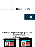 Arterosklerosis New