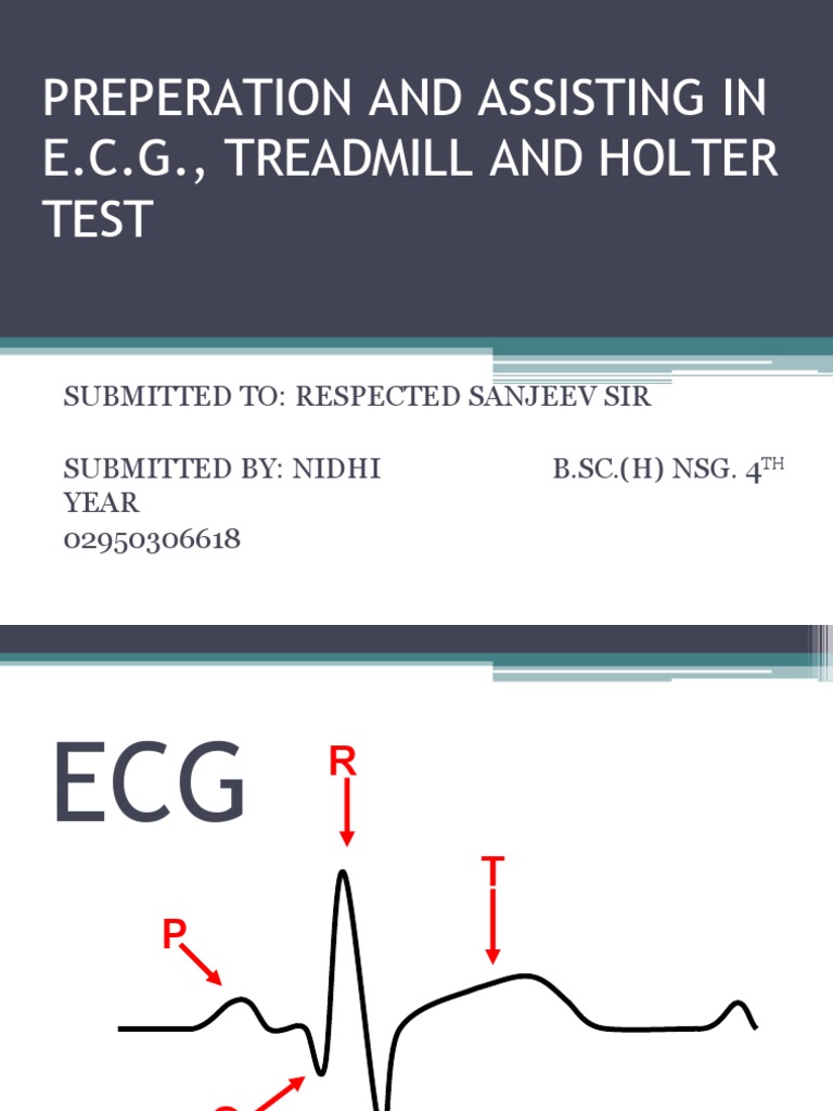 Ecg Treadmill and Holter Test PDF Electrocardiography Heart