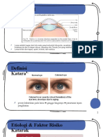 Minicex Cataract Alifah Ashil