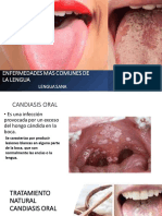 Enfermedades Comunes de La Lengua