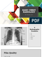 Basic Chest Radiology: ML Tolentino, M.D
