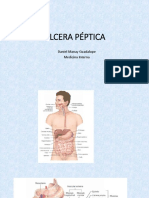 HDA - Úlcera - Gastritis