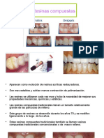 Resinas Compuestas