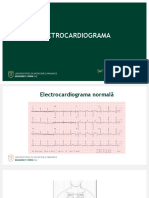 LP Electrocardiograma