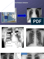 PRACTICA DE ESPIROMETRIA