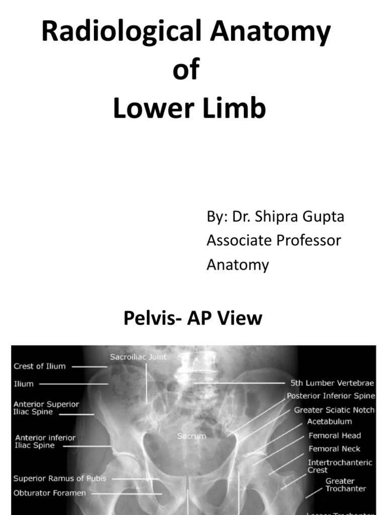 Radiology of Lower Limb | PDF