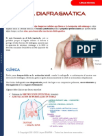 Ruptura Diafragmática