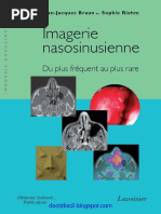 Tumeurs Malignes De L Oreille Pdf Melanome Metastase