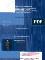 Polineuropatia