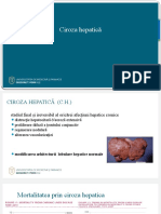 Ciroza Hepatica