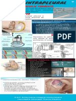 Via Intrapleural