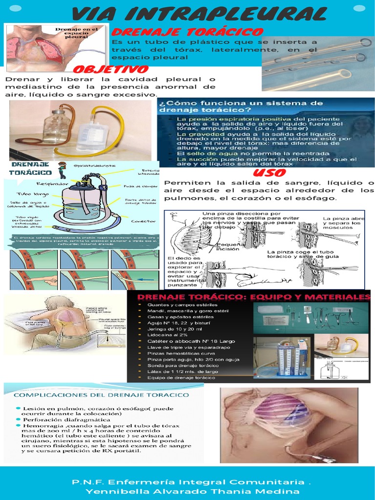 Intrapleural Catheter Pdf _ Cathéter Pleural Traitement – HXTGJW