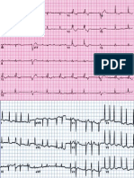 Ecg