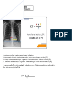 Neumonia RX