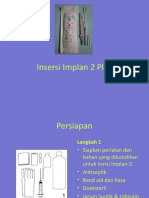 Insersi Implan 2 Plus