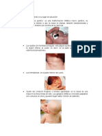 Masas y anormalidades comunes en el cuello y abdomen del recién nacido