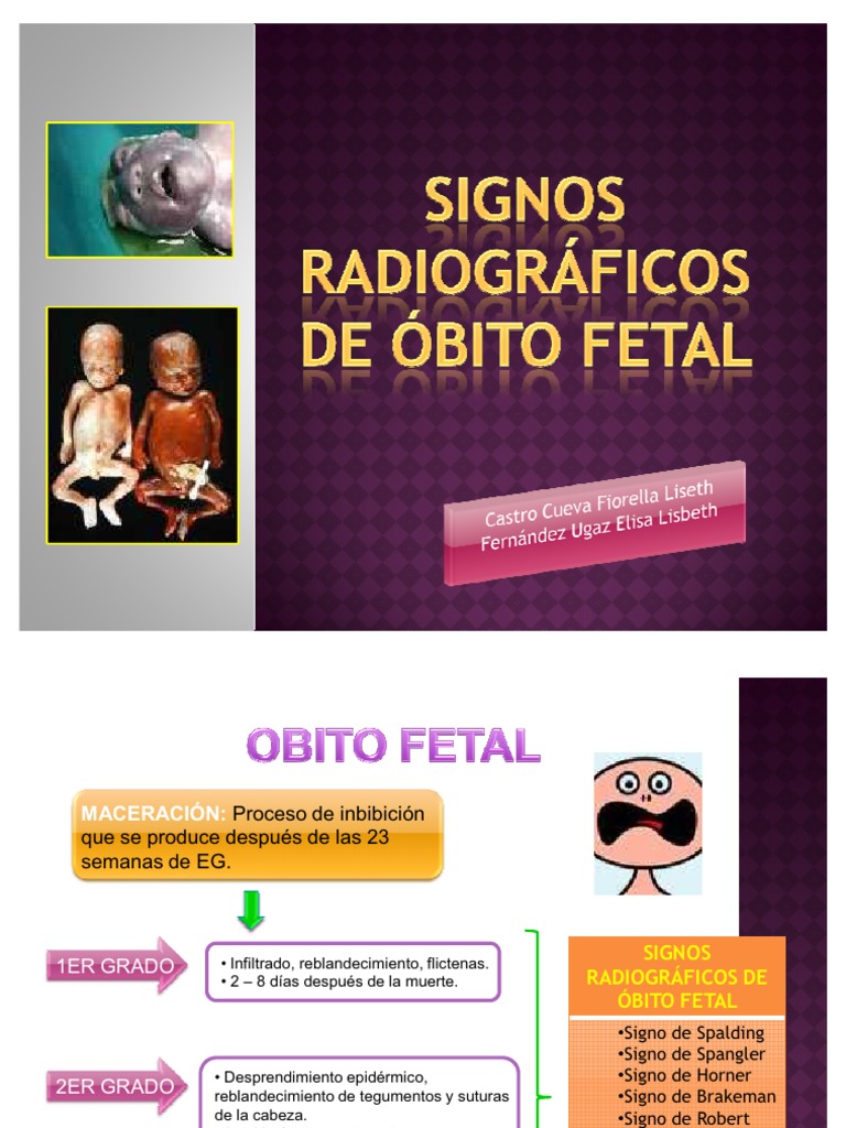 Signos Radiográficos de Óbito Fetal | PDF