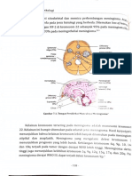 Meningioma