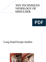 Injection Techniques On Pathology of Shoulder