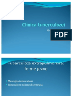 tuberculozac22222