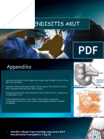 Apendisitis Akut