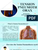 Tension Pneumoth Orax: Presented By: Juhara, Amroussie M. BSN 3 - D