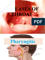 Diseases of Throat