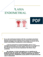 HIPERPLASIA Endometrial