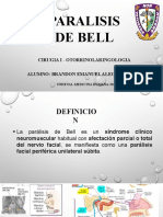 Paralisis de Bell